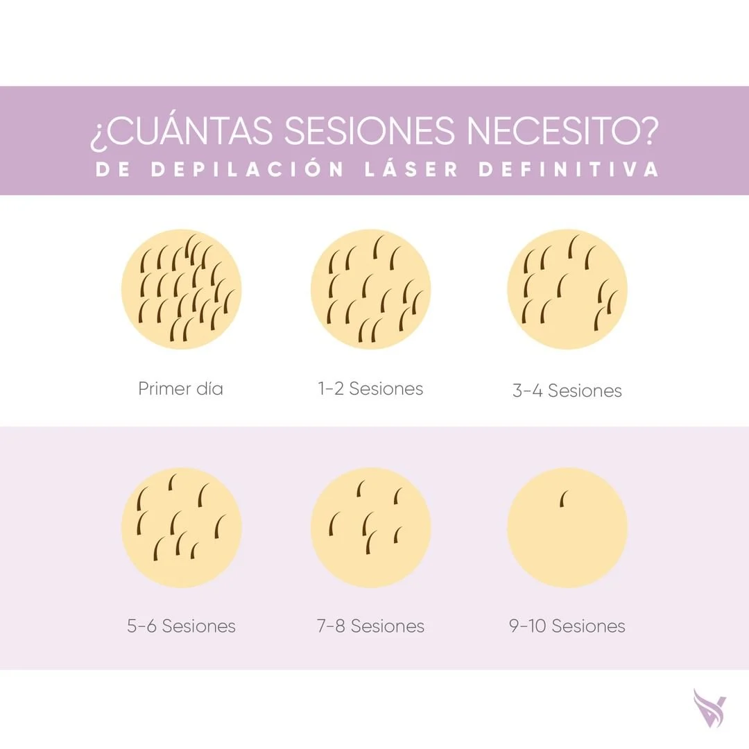 cuantas sesiones se necesitan de depilacion laser
