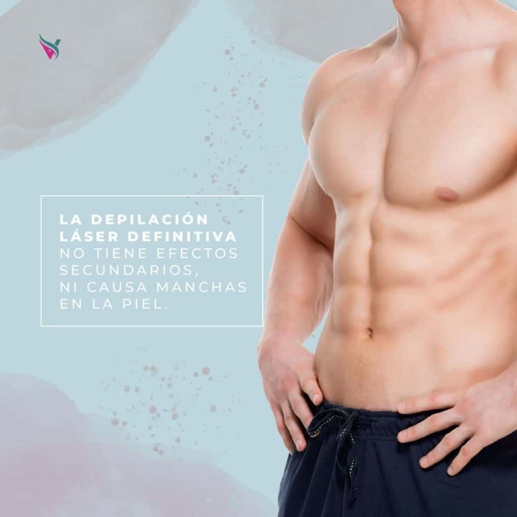 depilacion masculina paraguay laser definitiva